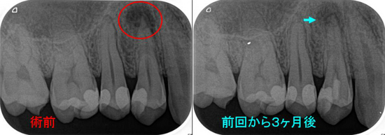 2019年7月アーカイブ - EE DENTAL_Blog